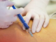 SUS oferece novo método de tratamento gratuito para varizes; veja dicas para evitar vasinhos, varizes e causas SUS oferece novo método de tratamento gratuito para varizes; veja dicas para evitar vasinhos, varizes e causas